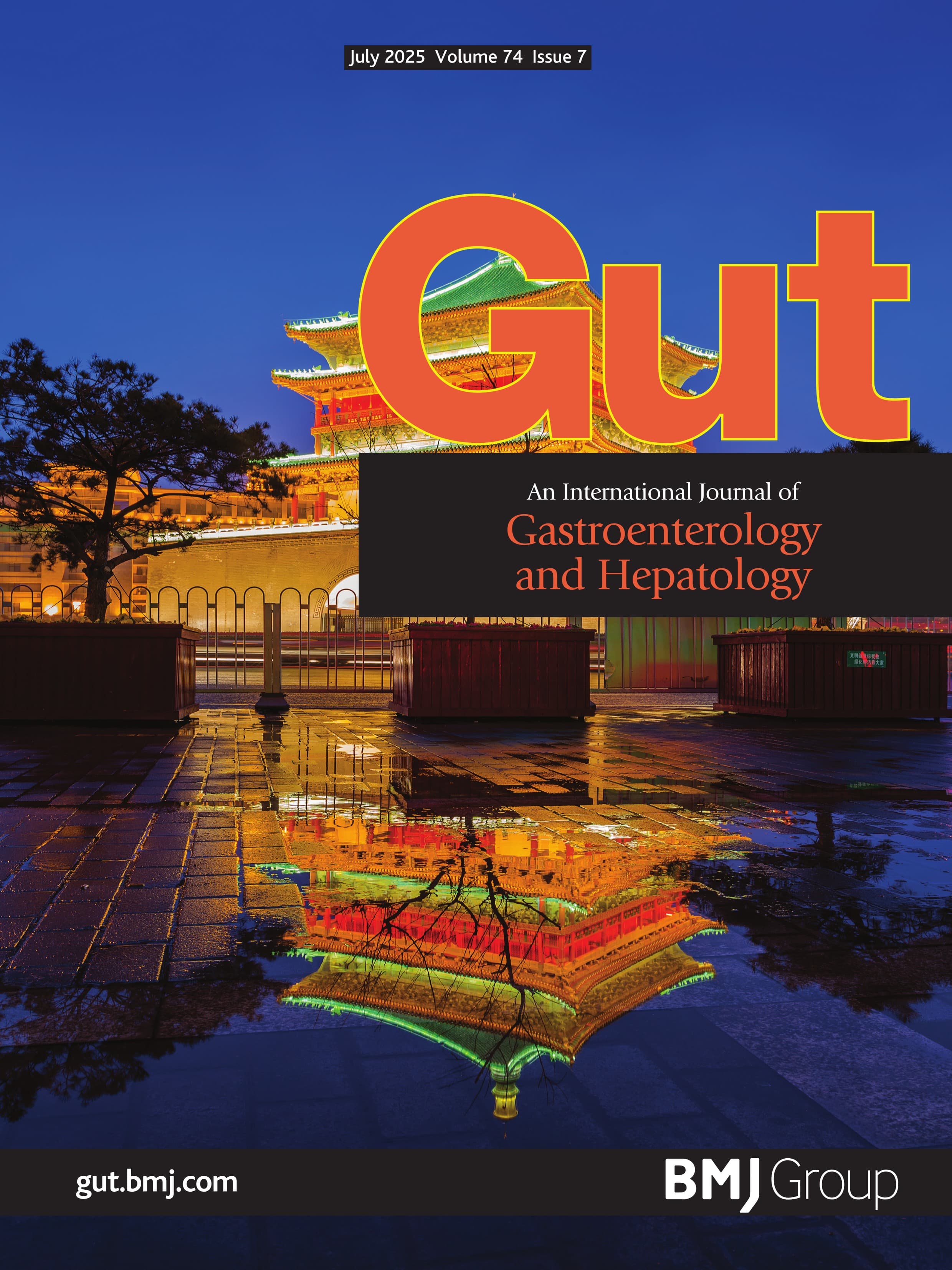 Lifestyle factors, genetic susceptibility and risk of incident diverticulitis: an integrated analysis of four prospective cohort studies and electronic health records-linked biobank