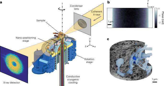 Nondestructive X-ray tomography of brain tissue ultrastructure