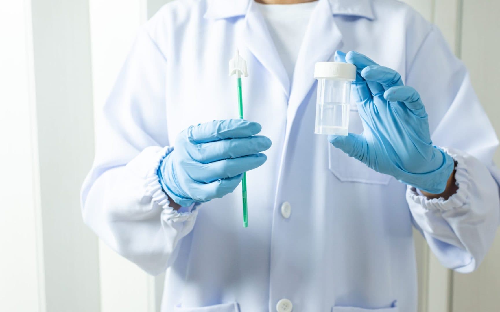 Cervical cancer testing takes unexpected turn