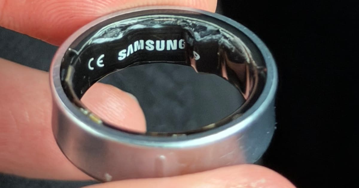 How A Swollen Smart Ring Landed A Tech Expert In The Emergency Room
