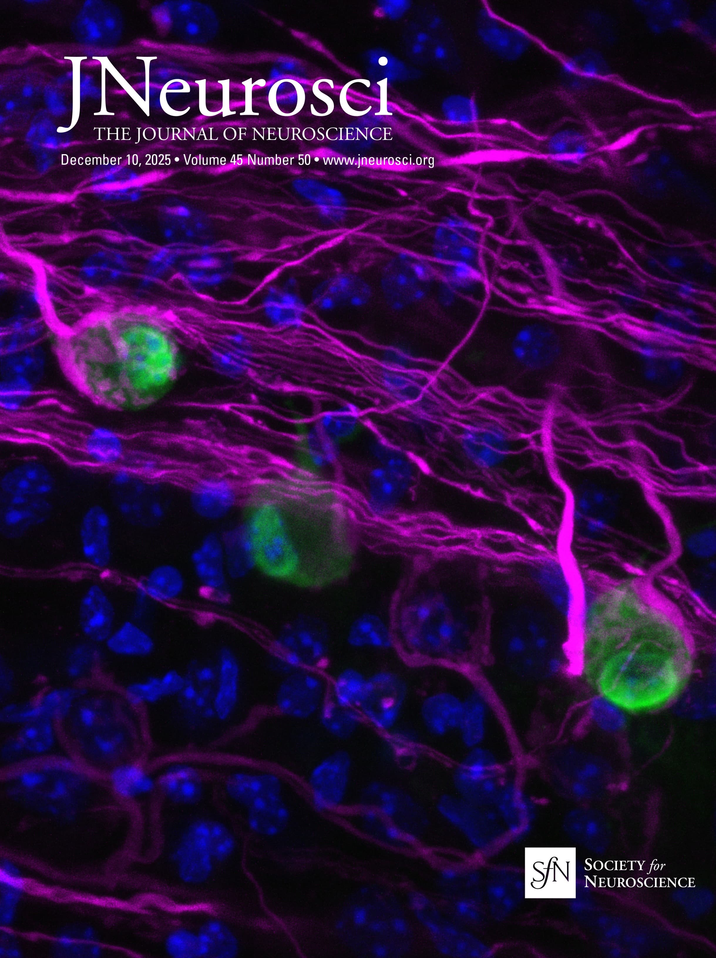 Energy Deficit Is a Key Driver of Sleep Homeostasis